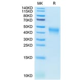 Tris-Bis PAGE - Recombinant Cynomolgus macaque CD80 Protein (C-terminal His Tag) (A331461) - Antibodies.com