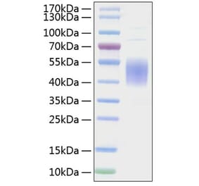SDS-PAGE - Recombinant Mouse CD80 Protein (C-terminal His Tag) (A331462) - Antibodies.com