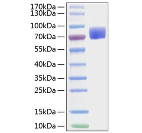 SDS-PAGE - Recombinant Mouse CD80 Protein (C-terminal Human Fc and His Tag) (A331463) - Antibodies.com