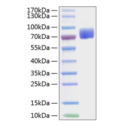 SDS-PAGE - Recombinant Mouse CD80 Protein (C-terminal Human Fc and His Tag) (A331463) - Antibodies.com