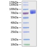 SDS-PAGE - Recombinant Mouse CD80 Protein (C-terminal Human Fc and His Tag) (A331463) - Antibodies.com