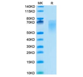 Tris-Bis PAGE - Recombinant Cynomolgus macaque CD86 Protein (C-terminal His Tag) (A331464) - Antibodies.com