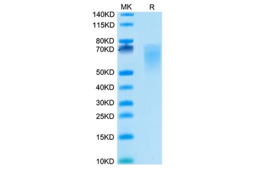 Tris-Bis PAGE - Recombinant Cynomolgus macaque CD86 Protein (C-terminal His Tag) (A331464) - Antibodies.com