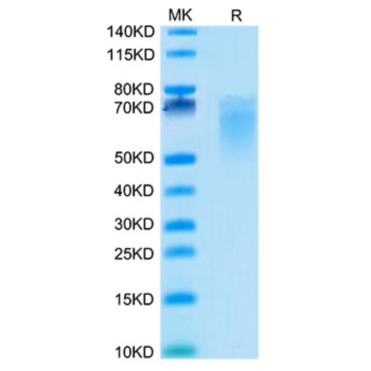 Tris-Bis PAGE - Recombinant Cynomolgus macaque CD86 Protein (C-terminal His Tag) (A331464) - Antibodies.com