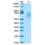 Tris-Bis PAGE - Recombinant Cynomolgus macaque CD86 Protein (C-terminal His Tag) (A331464) - Antibodies.com