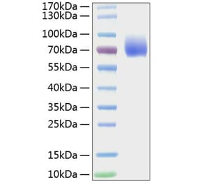 SDS-PAGE - Recombinant Mouse CD86 Protein (C-terminal Human Fc Tag) (A331465) - Antibodies.com