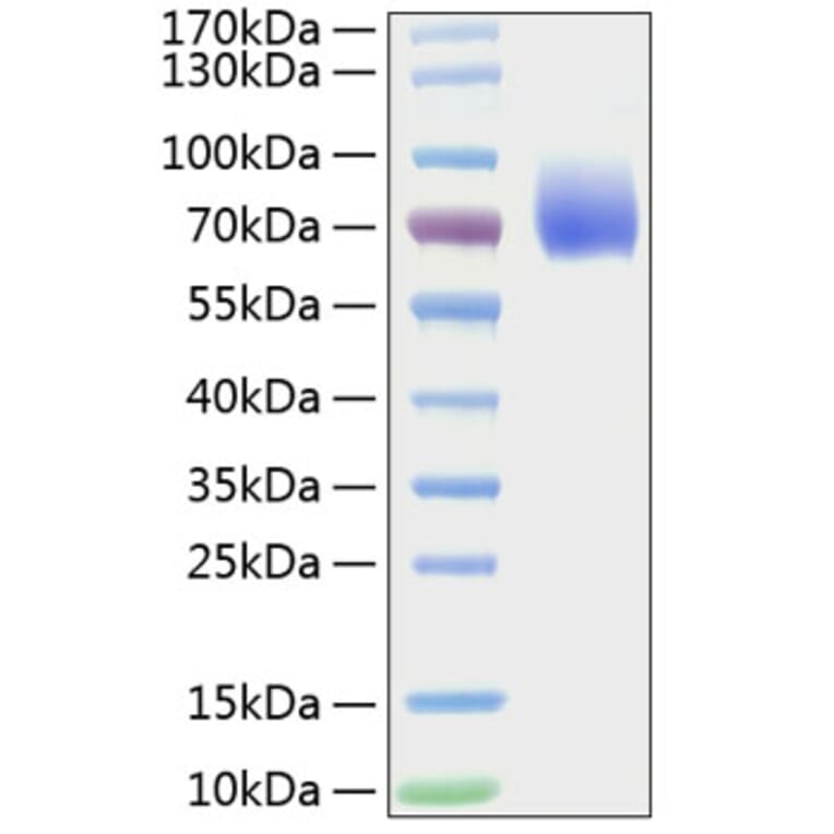 SDS-PAGE - Recombinant Mouse CD86 Protein (C-terminal Human Fc Tag) (A331465) - Antibodies.com