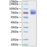 SDS-PAGE - Recombinant Mouse CD86 Protein (C-terminal Human Fc Tag) (A331465) - Antibodies.com