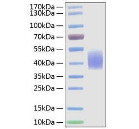 SDS-PAGE - Recombinant Mouse CD86 Protein (C-terminal His Tag) (A331466) - Antibodies.com