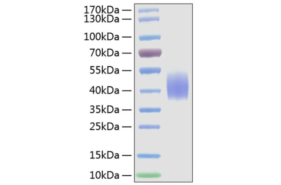 SDS-PAGE - Recombinant Mouse CD86 Protein (C-terminal His Tag) (A331466) - Antibodies.com