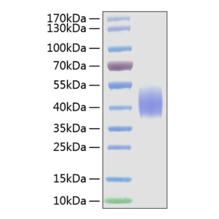 SDS-PAGE - Recombinant Mouse CD86 Protein (C-terminal His Tag) (A331466) - Antibodies.com