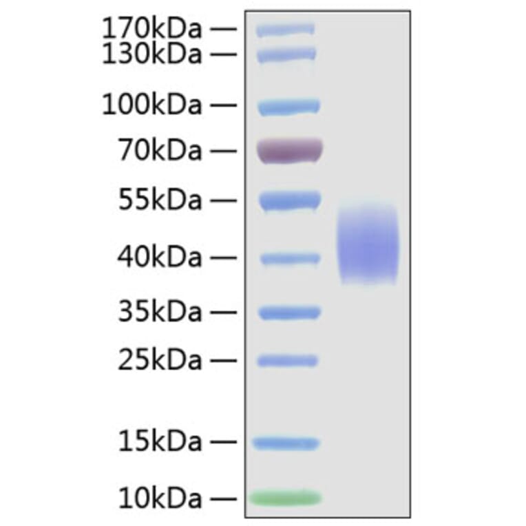 SDS-PAGE - Recombinant Mouse CD86 Protein (C-terminal His Tag) (A331466) - Antibodies.com