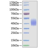 SDS-PAGE - Recombinant Mouse CD86 Protein (C-terminal His Tag) (A331466) - Antibodies.com