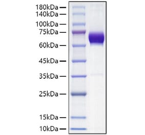 SDS-PAGE - Recombinant Mouse PD-L2 Protein (C-terminal Human Fc Tag) (A331467) - Antibodies.com