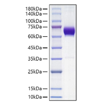 SDS-PAGE - Recombinant Mouse PD-L2 Protein (C-terminal Human Fc Tag) (A331467) - Antibodies.com