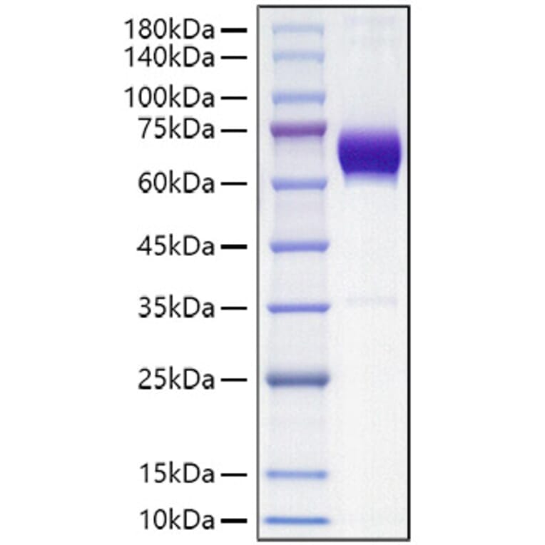 SDS-PAGE - Recombinant Mouse PD-L2 Protein (C-terminal Human Fc Tag) (A331467) - Antibodies.com