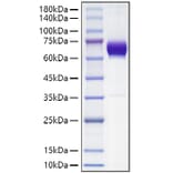 SDS-PAGE - Recombinant Mouse PD-L2 Protein (C-terminal Human Fc Tag) (A331467) - Antibodies.com