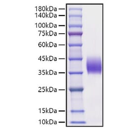 SDS-PAGE - Recombinant Mouse PD-L2 Protein (C-terminal His Tag) (A331468) - Antibodies.com