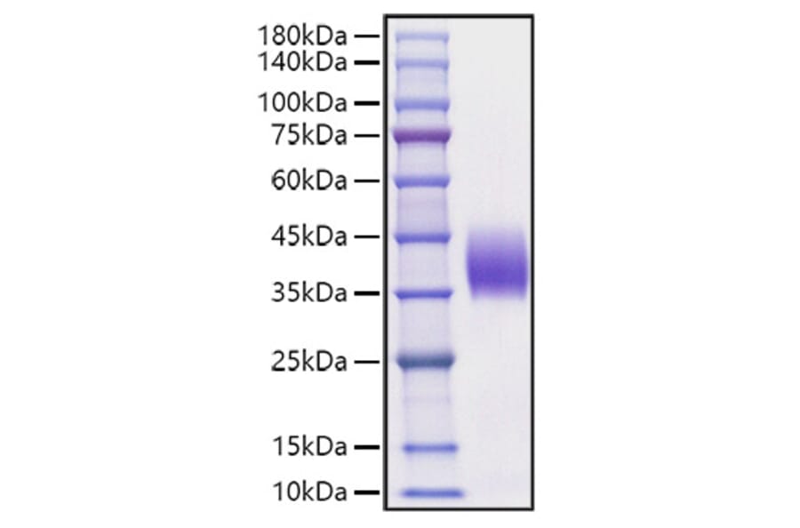 SDS-PAGE - Recombinant Mouse PD-L2 Protein (C-terminal His Tag) (A331468) - Antibodies.com