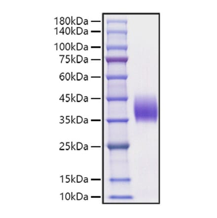 SDS-PAGE - Recombinant Mouse PD-L2 Protein (C-terminal His Tag) (A331468) - Antibodies.com