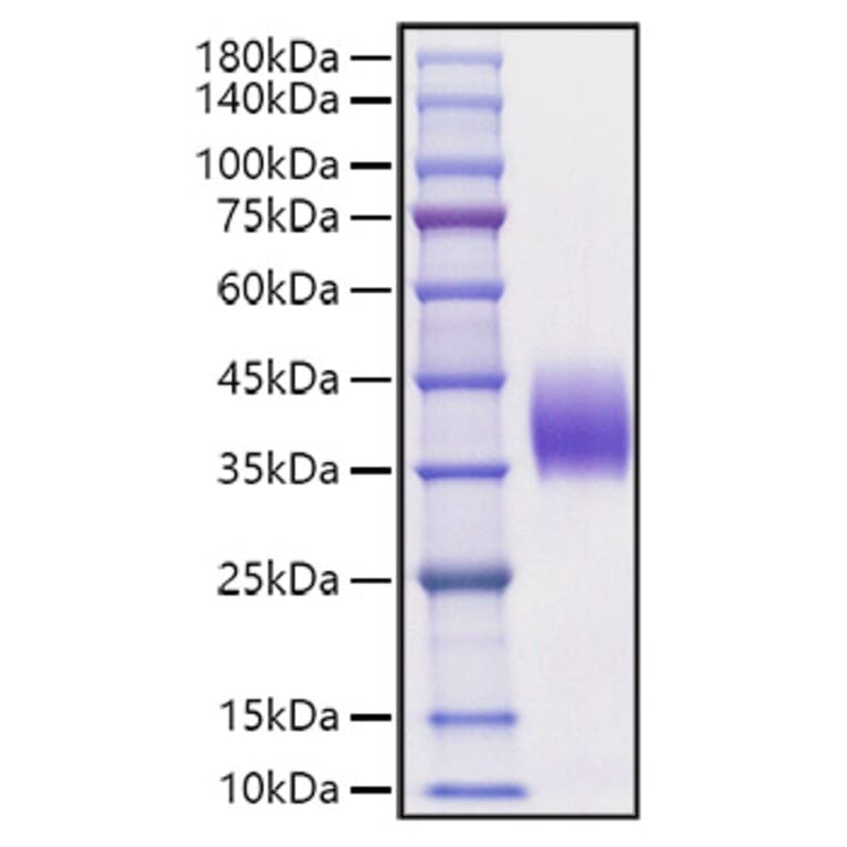 SDS-PAGE - Recombinant Mouse PD-L2 Protein (C-terminal His Tag) (A331468) - Antibodies.com