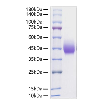 SDS-PAGE - Recombinant Rat PD-L1 Protein (C-terminal His Tag) (A331469) - Antibodies.com