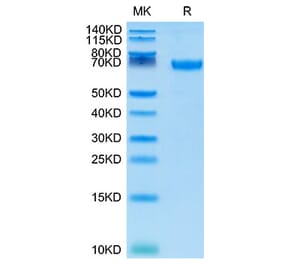 Tris-Bis PAGE - Recombinant Cynomolgus macaque PD-L1 Protein (C-terminal Human Fc Tag) (A331470) - Antibodies.com