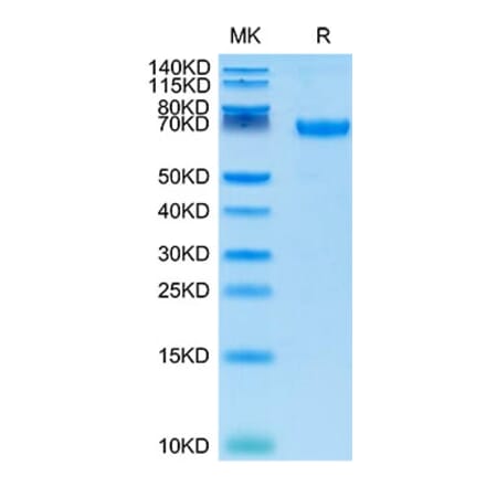 Tris-Bis PAGE - Recombinant Cynomolgus macaque PD-L1 Protein (C-terminal Human Fc Tag) (A331470) - Antibodies.com