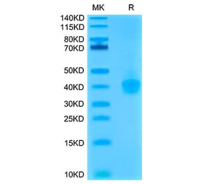 Tris-Bis PAGE - Recombinant Cynomolgus macaque PD-L1 Protein (C-terminal His Tag) (A331471) - Antibodies.com