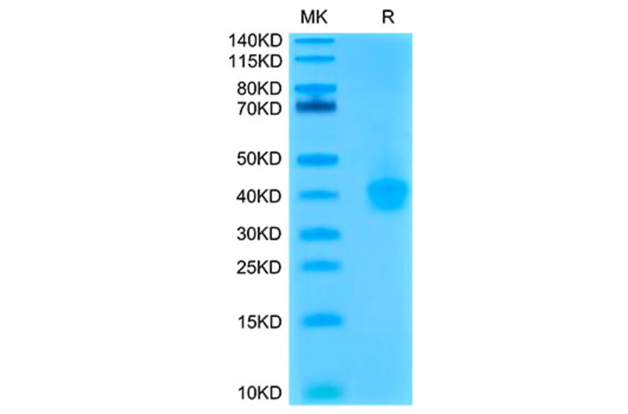 Tris-Bis PAGE - Recombinant Cynomolgus macaque PD-L1 Protein (C-terminal His Tag) (A331471) - Antibodies.com