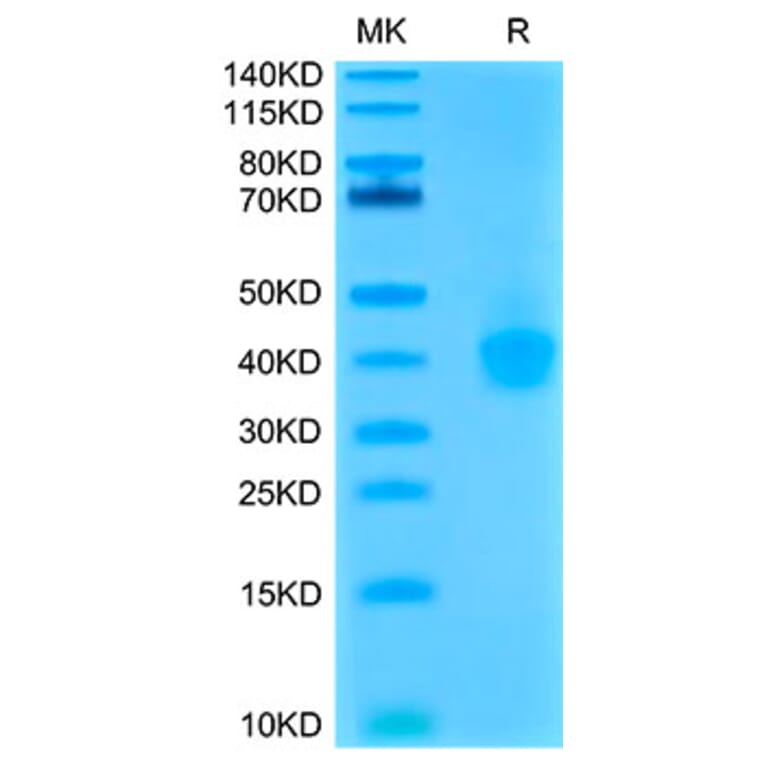 Tris-Bis PAGE - Recombinant Cynomolgus macaque PD-L1 Protein (C-terminal His Tag) (A331471) - Antibodies.com