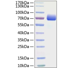 SDS-PAGE - Recombinant Mouse PD-L1 Protein (C-terminal Human Fc and His Tag) (A331472) - Antibodies.com