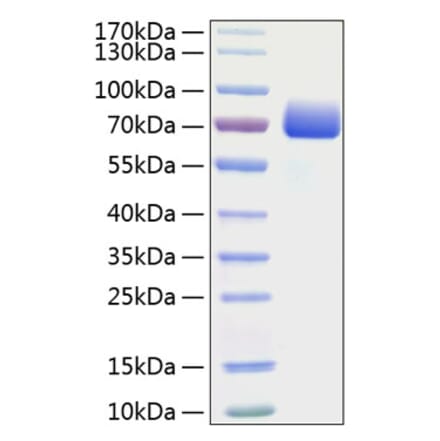 SDS-PAGE - Recombinant Mouse PD-L1 Protein (C-terminal Human Fc and His Tag) (A331472) - Antibodies.com