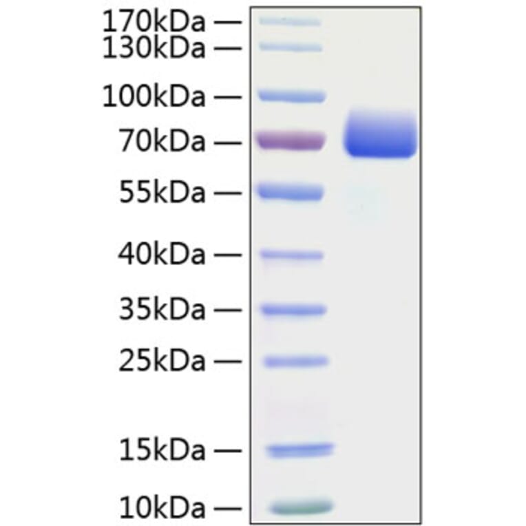 SDS-PAGE - Recombinant Mouse PD-L1 Protein (C-terminal Human Fc and His Tag) (A331472) - Antibodies.com