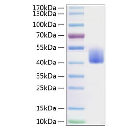 SDS-PAGE - Recombinant Mouse PD-L1 Protein (C-terminal His Tag) (A331473) - Antibodies.com