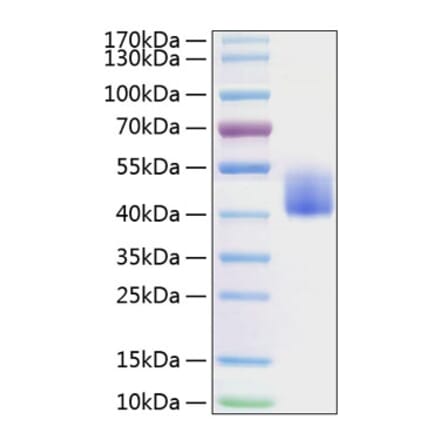 SDS-PAGE - Recombinant Mouse PD-L1 Protein (C-terminal His Tag) (A331473) - Antibodies.com