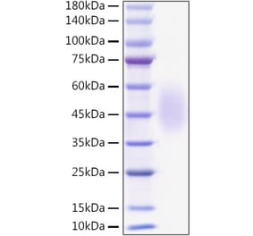 SDS-PAGE - Recombinant Mouse B7-H2 Protein (C-terminal His Tag) (A331474) - Antibodies.com