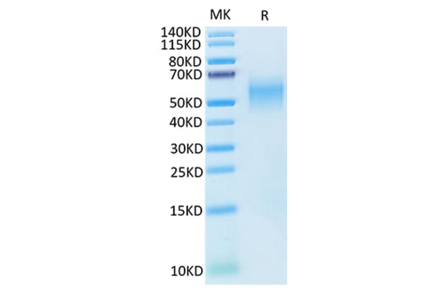 Tris-Bis PAGE - Recombinant Cynomolgus macaque B7-H2 Protein (C-terminal His Tag) (A331475) - Antibodies.com