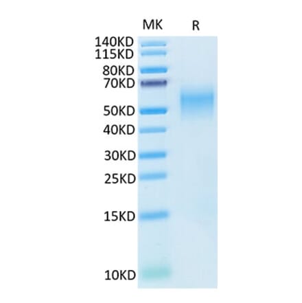Tris-Bis PAGE - Recombinant Cynomolgus macaque B7-H2 Protein (C-terminal His Tag) (A331475) - Antibodies.com