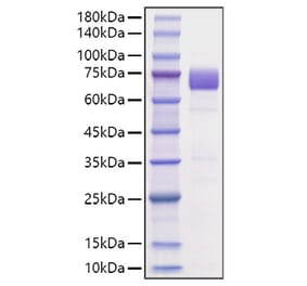 SDS-PAGE - Recombinant Mouse B7-H3 Protein (C-terminal Human Fc Tag) (A331476) - Antibodies.com