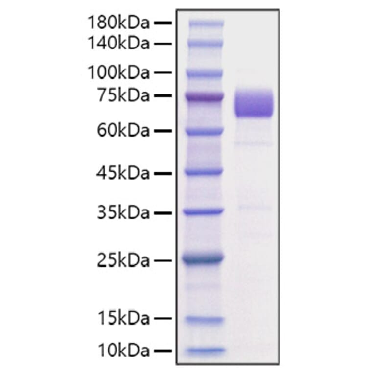 SDS-PAGE - Recombinant Mouse B7-H3 Protein (C-terminal Human Fc Tag) (A331476) - Antibodies.com