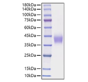 SDS-PAGE - Recombinant Mouse B7-H3 Protein (C-terminal His Tag) (A331477) - Antibodies.com