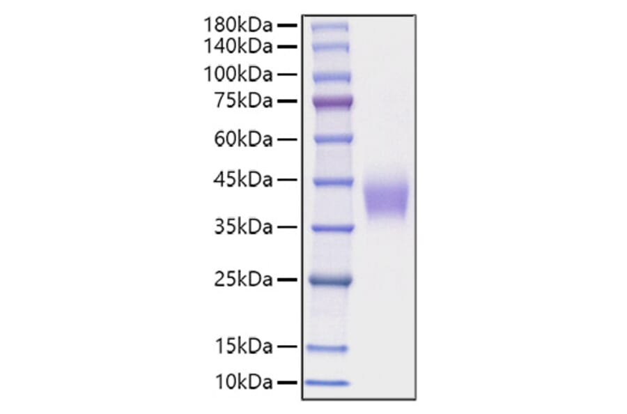 SDS-PAGE - Recombinant Mouse B7-H3 Protein (C-terminal His Tag) (A331477) - Antibodies.com