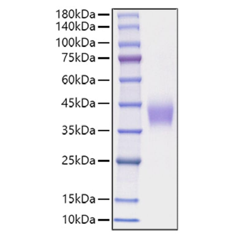 SDS-PAGE - Recombinant Mouse B7-H3 Protein (C-terminal His Tag) (A331477) - Antibodies.com