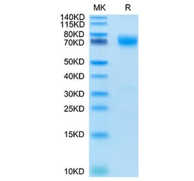 Tris-Bis PAGE - Recombinant Cynomolgus macaque B7-H3 Protein (C-terminal His Tag) (A331478) - Antibodies.com