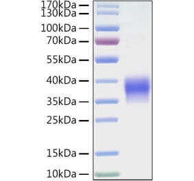 SDS-PAGE - Recombinant Mouse VISTA Protein (C-terminal His Tag) (A331479) - Antibodies.com