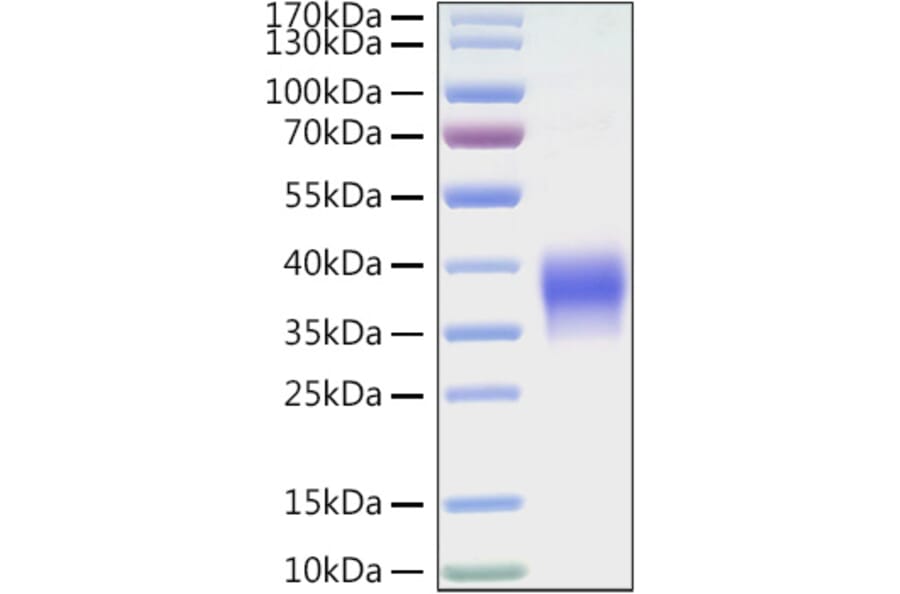 SDS-PAGE - Recombinant Mouse VISTA Protein (C-terminal His Tag) (A331479) - Antibodies.com
