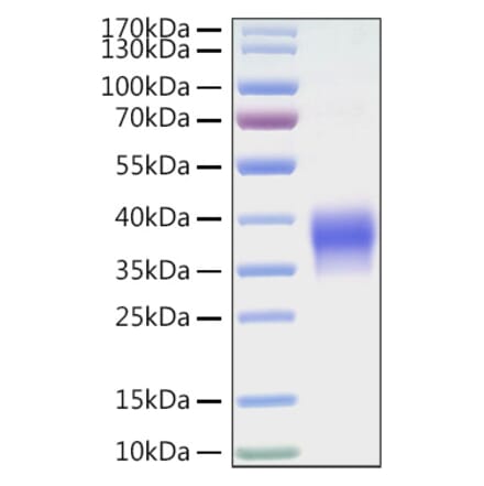 SDS-PAGE - Recombinant Mouse VISTA Protein (C-terminal His Tag) (A331479) - Antibodies.com