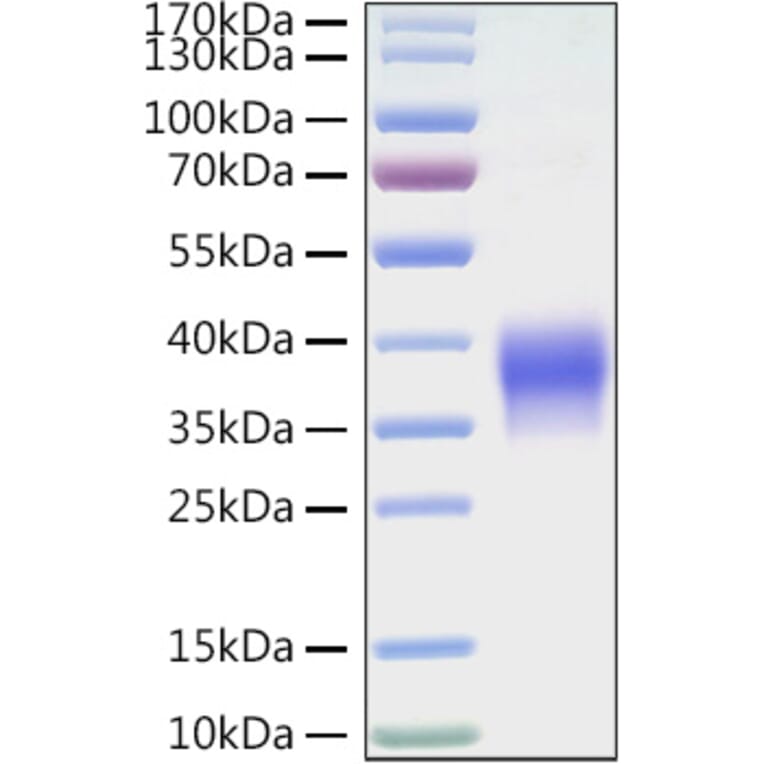 SDS-PAGE - Recombinant Mouse VISTA Protein (C-terminal His Tag) (A331479) - Antibodies.com