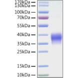 SDS-PAGE - Recombinant Mouse VISTA Protein (C-terminal His Tag) (A331479) - Antibodies.com